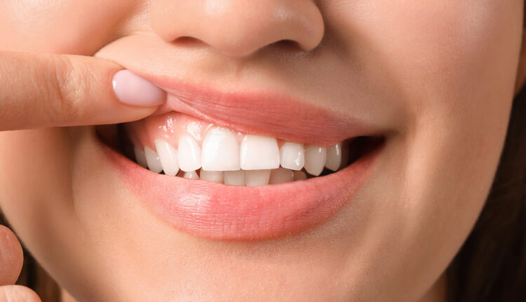 1724666304 616 اگر روزی یک عدد موز بخوریم، چه اتفاقی می‌افتد؟ ساحل دانش