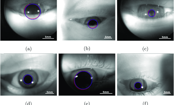 تصویر آزمایش سنجش اندازه مردمک چشم