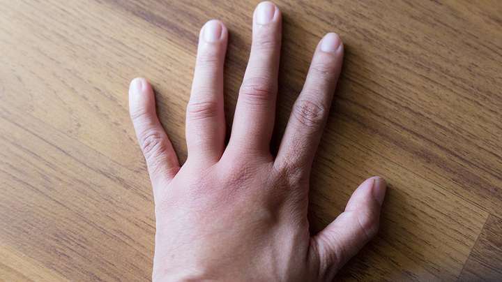 تشخیص جای نیش حشرات گوناگون و نحوه درمان آنها_ساحل دانش 57 نیش زنبور
