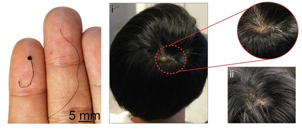 گسترش الکترود ثبت نوار مغزی تازه که به اندازه یک تار مو است_ساحل دانش 3 الکترود شبیه به مو
